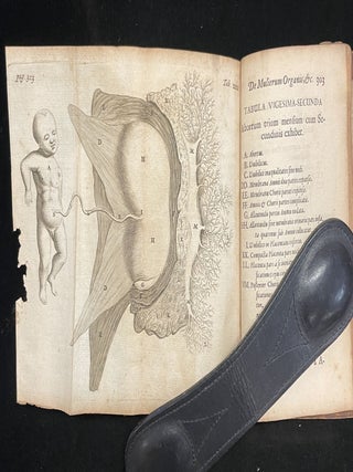 De mulierum organis generationi inservientibus tractatus novus